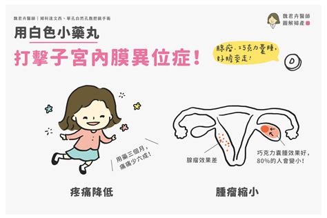 異位寧禁忌|子宮內膜異位症新藥